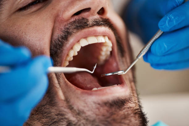 Best Oral Cancer Screening  in Harrogate, TN